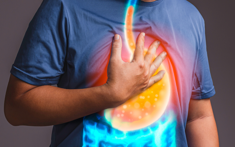 Anti - Reflux Surgery