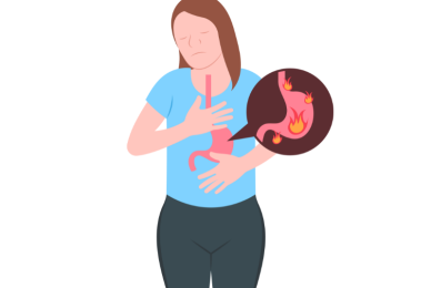 Anti Reflux Surgery
