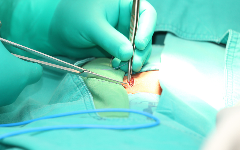 Hernia Repair Hernia Surgery