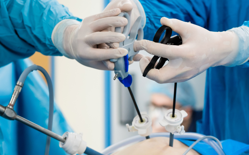 Laparoscopic Hernia Surgery