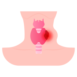 Neck Problems