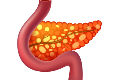 Pancreatic Surgery