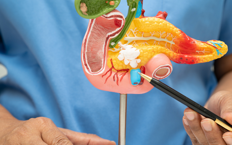 Pancreatitis