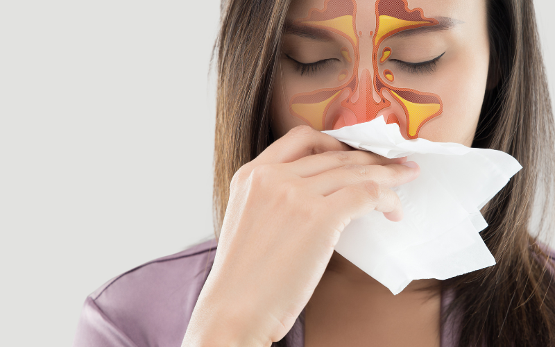 Pilonidal Sinus