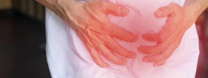 Umbilical Hernia