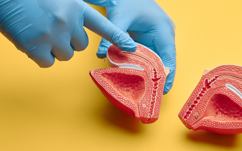 Gall bladder removal