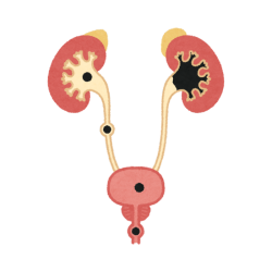 Kidney stone