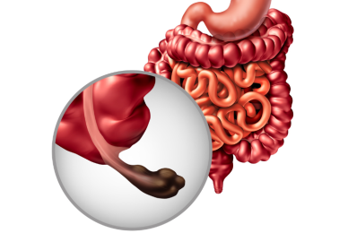 appendix removal surgery